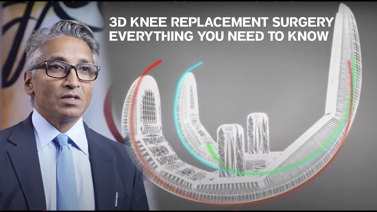 3D Knee Replacement Surgery in Dubai | Dr Paul Jairaj - Everything You Need to Know