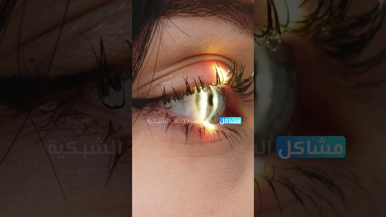 Dr. Hassan Abdul Aziz | Ophthalmologist in Dubai