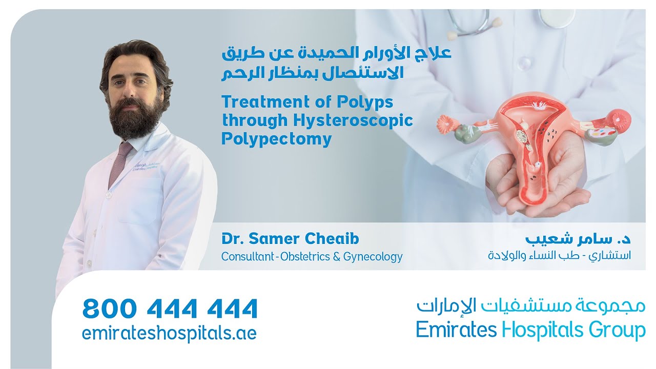 Polyps Treatment through Hysteroscopic Polypectomy - Dr. Samer Cheaib, Cons. Obstetrics & Gynecology