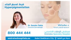 Hyperpigmentation - Dr. Sandra Takla , Consultant Dermatologist