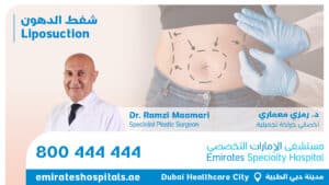 Liposuction - Dr. Ramzi Maamari Specialist Plastic Surgeon