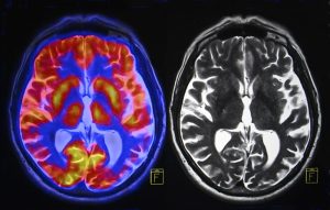 Neurologist Specialist Near Me
