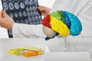 Neurologist Specialist in Dubai