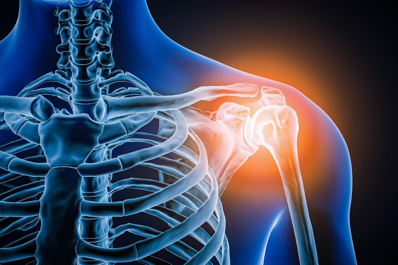 Shoulder Arthroscopy