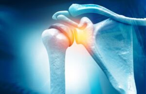 Shoulder Pain Doctors Dubai