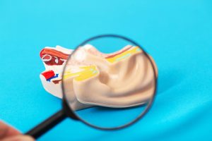  Otosclerosis-treatments