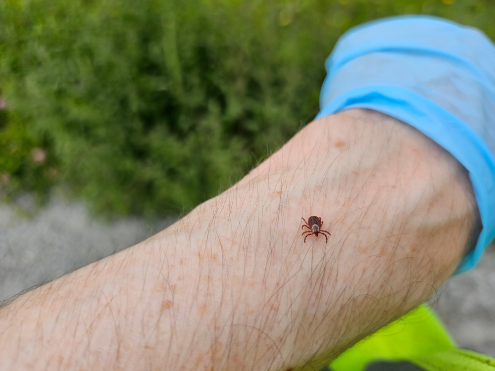 Lyme Disease