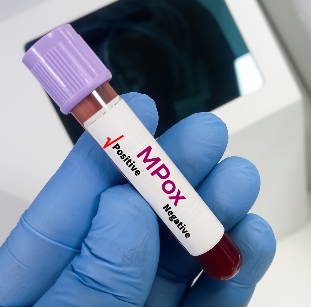 Mpox Virus