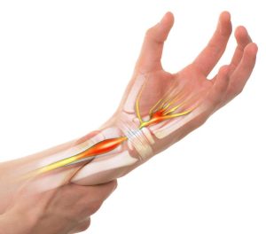 hand and wrist tendon injury clinic