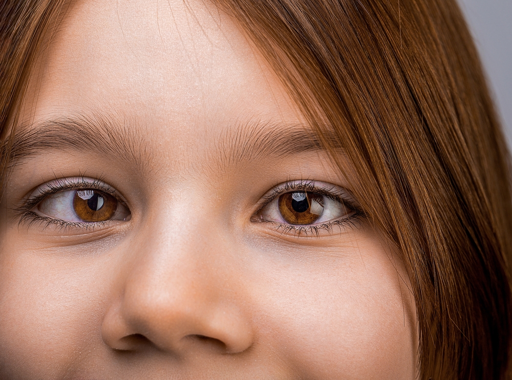 Strabismus – Squinting