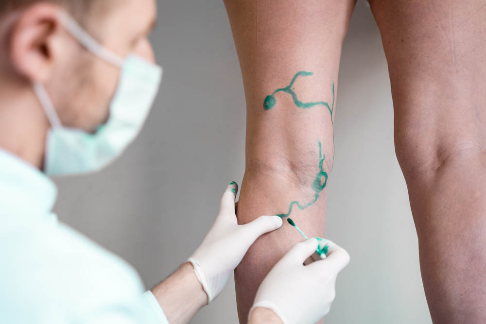 Vascular Surgery
