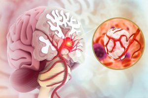 cancer treatment in dubai