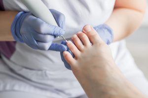 Ingrown Toenails Removal in dubai