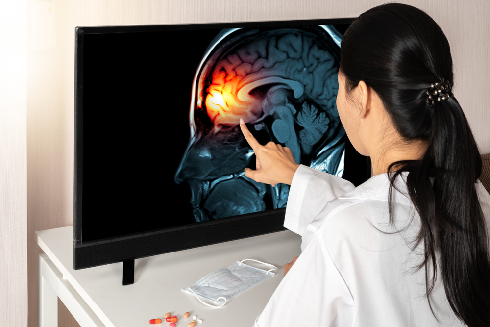Choroid Plexus