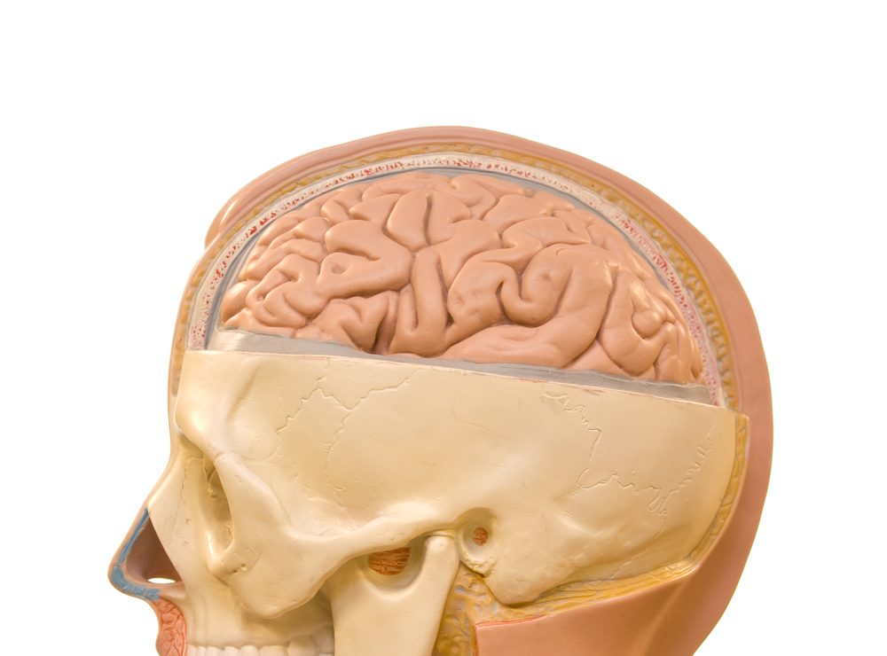 Craniotomy