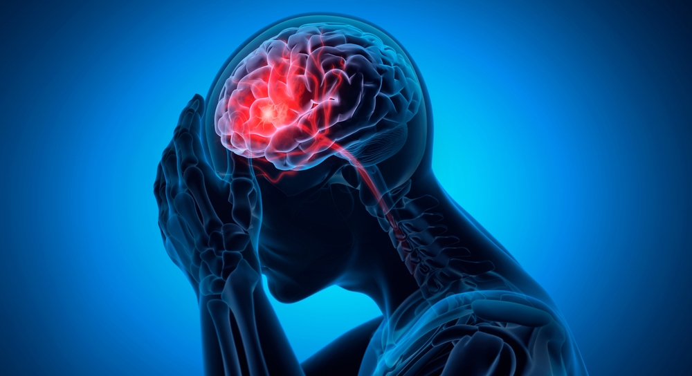 Intracranial Hemorrhages