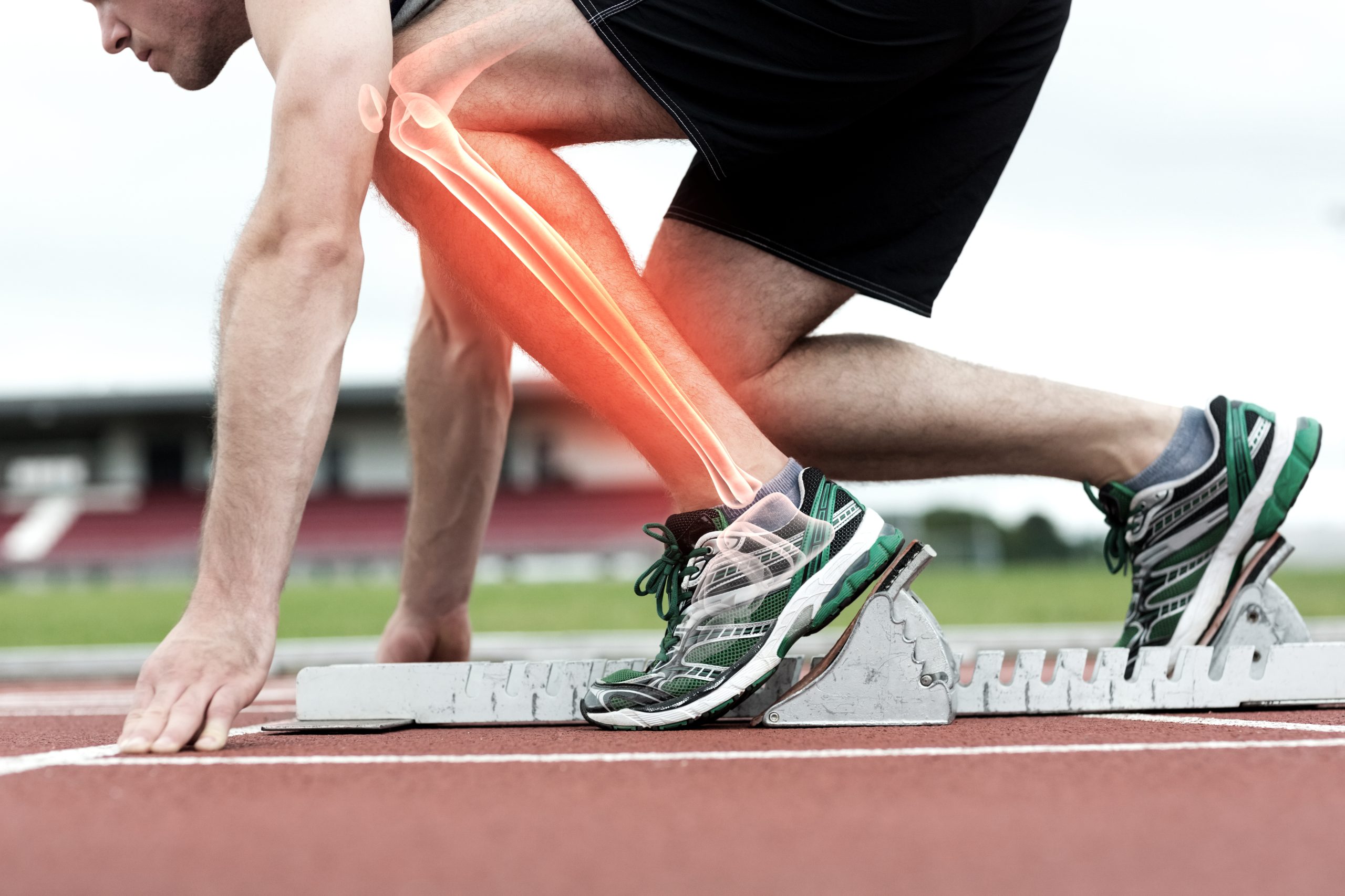 Bleeding into the muscle and soft tissue – Causes, Diagnosis, and Treatment