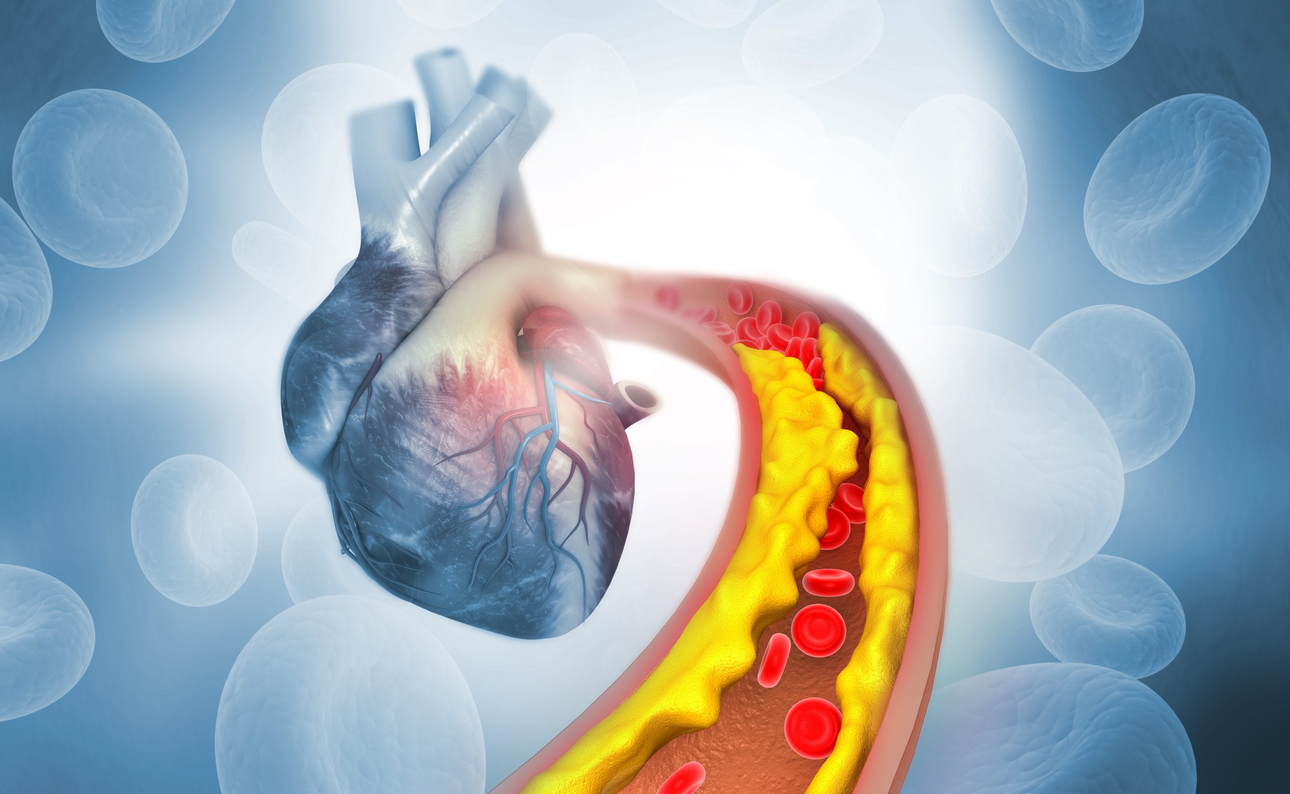 Blood Clots– Causes, Diagnosis, and Treatment