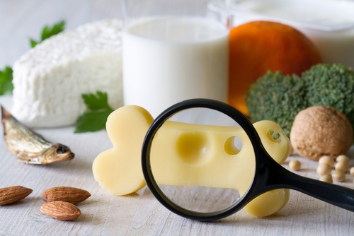 Decreased Bone Density – Causes, Diagnosis & Treatment