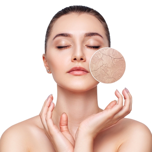 Dry Skin – Causes, Diagnosis, and Treatment