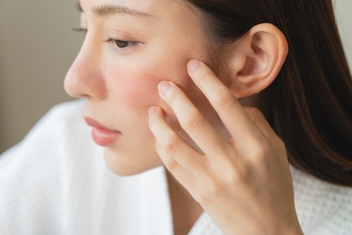 Eczema – Causes, Diagnosis, and Treatment