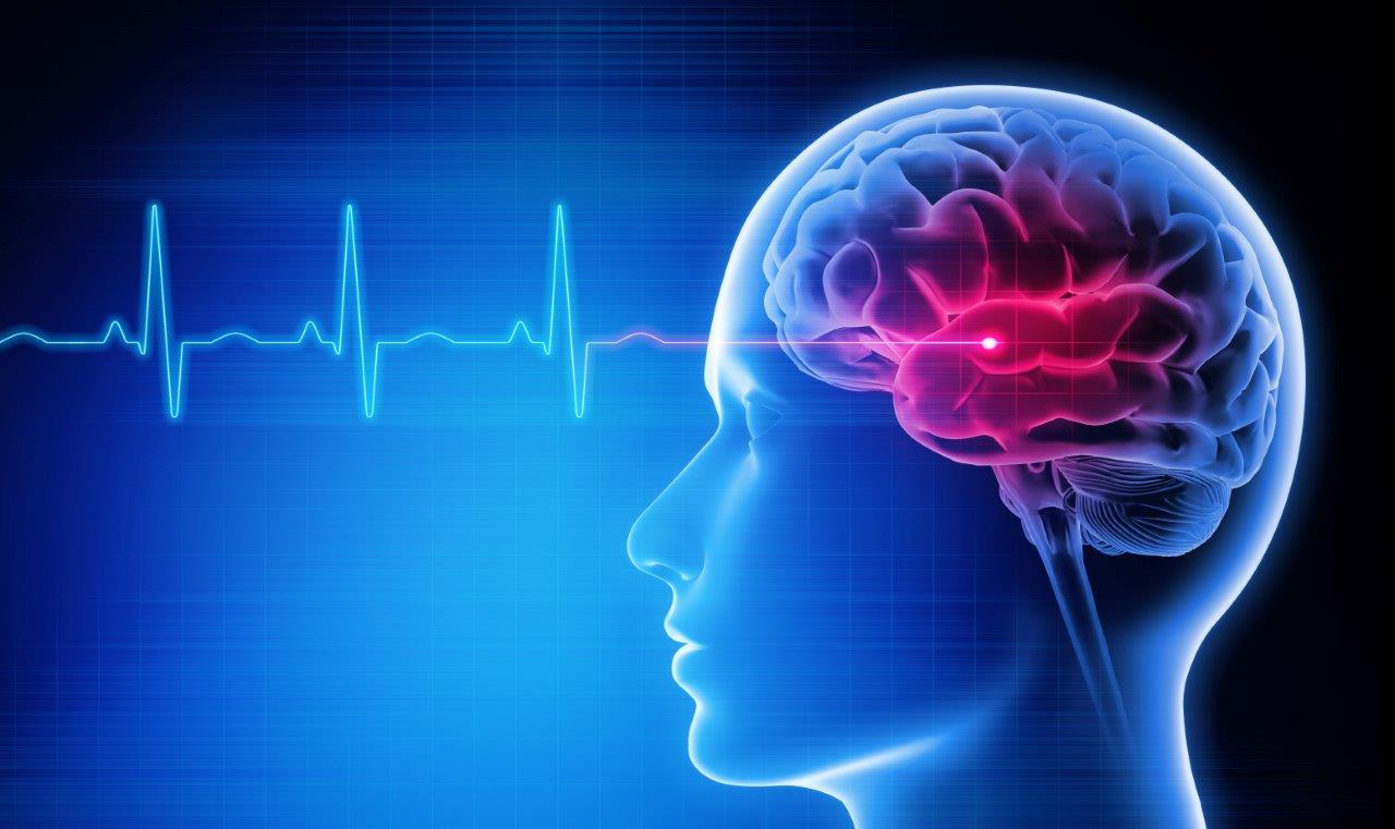 Frequent Headaches – Causes, Diagnosis and Treatment