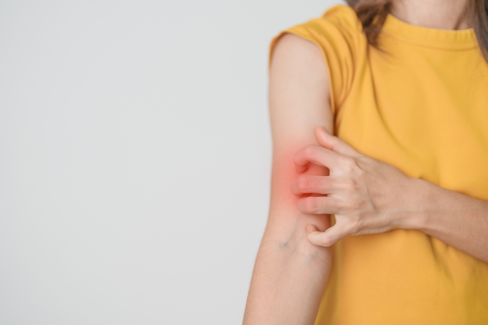 Itchy Skin – Causes, Diagnosis, and Treatment