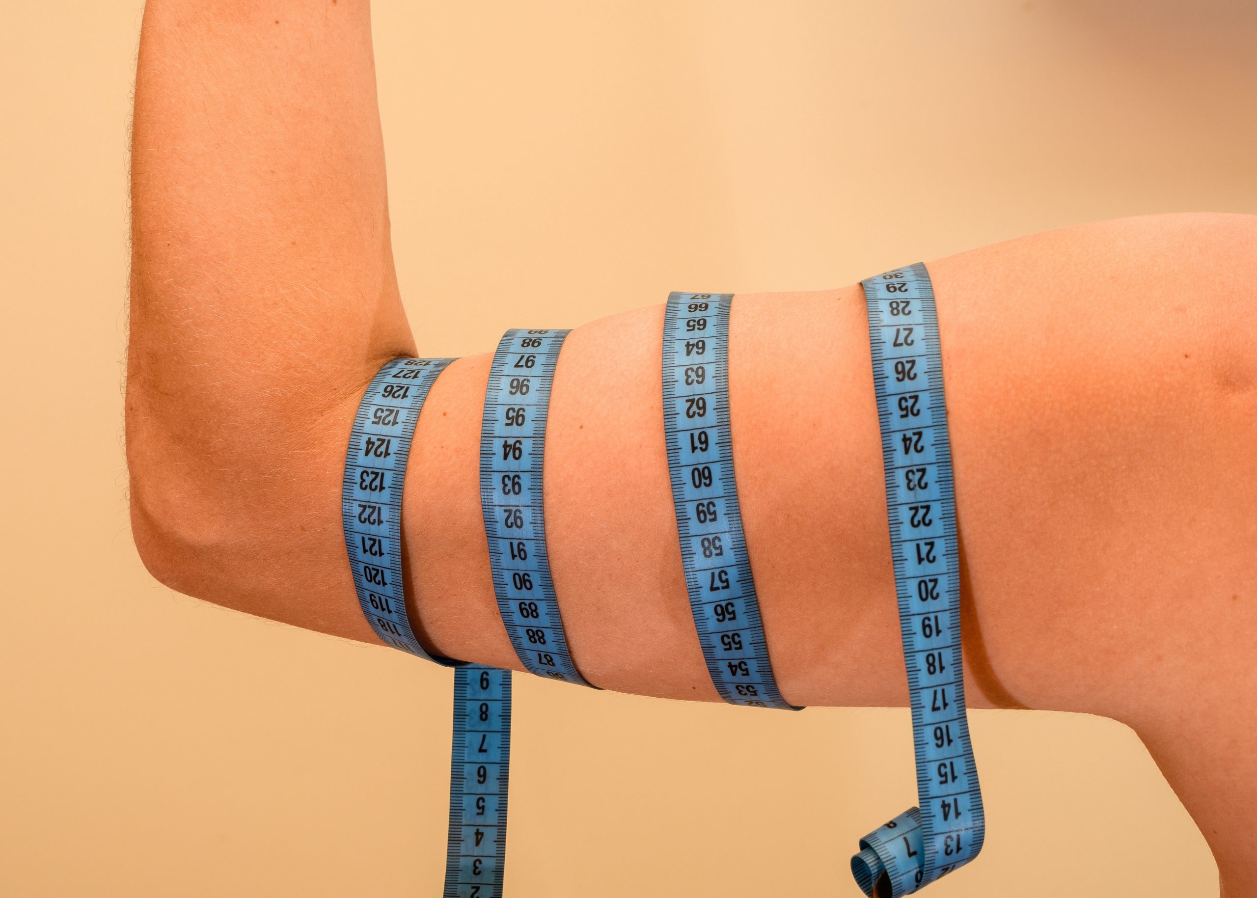 Muscle Atrophy – Causes, Diagnosis, and Treatment