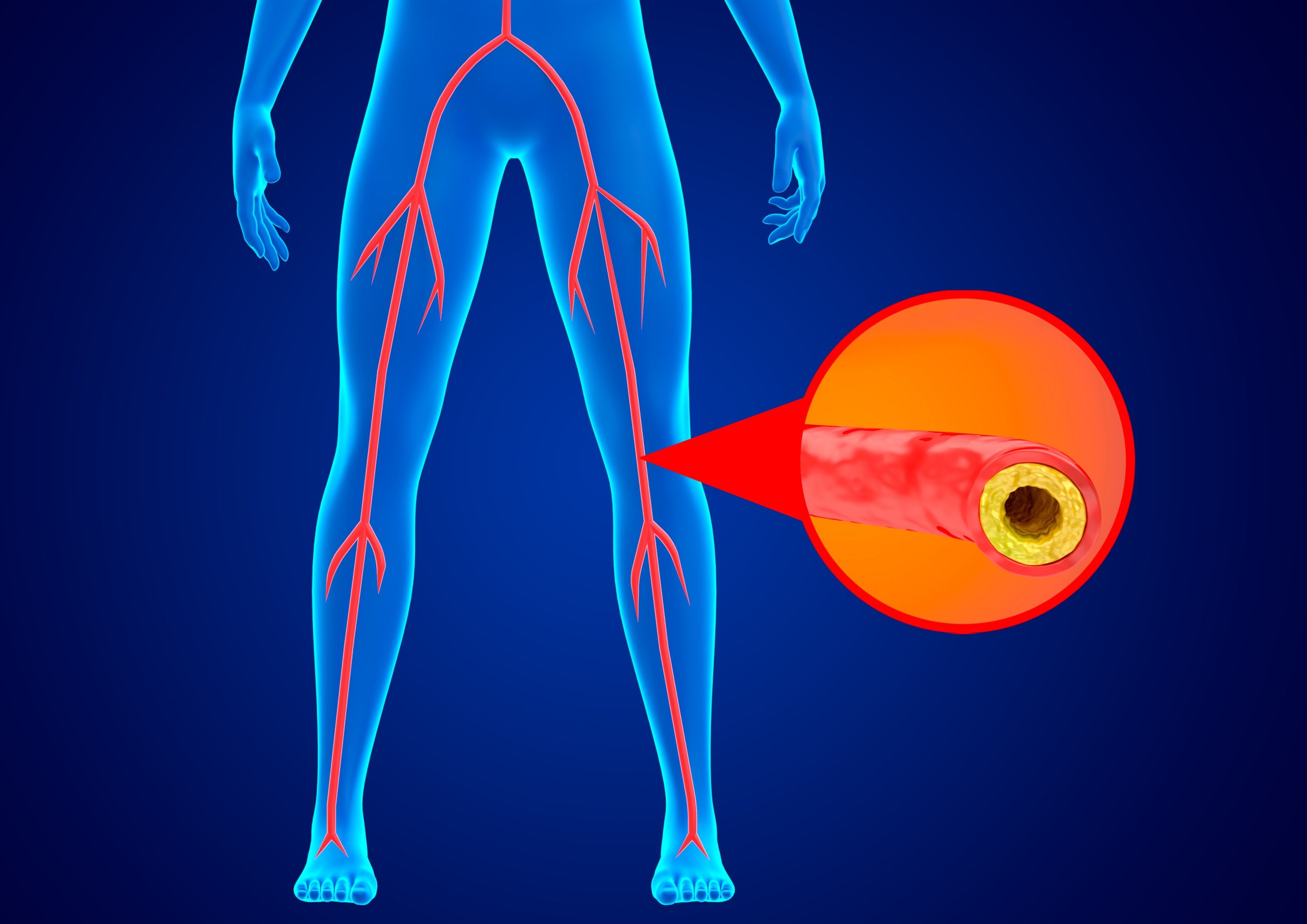 Non-Healing Ulcers on the Feet or Legs – Causes, Diagnosis, and Treatment