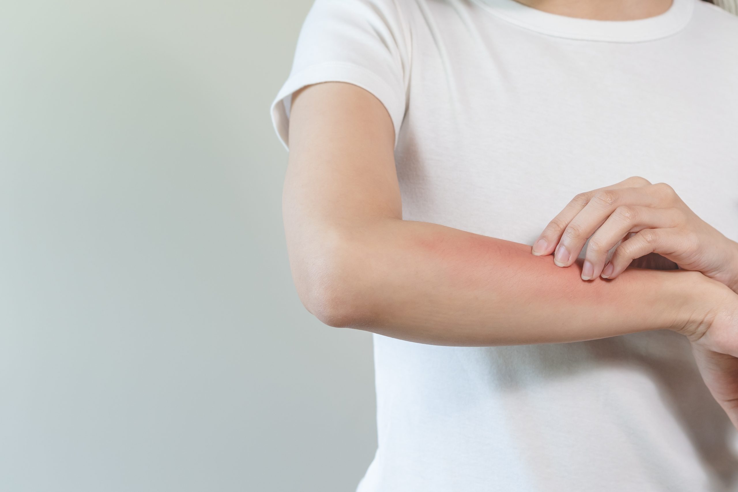 Painful or itchy rash – Causes, Diagnosis & Treatment