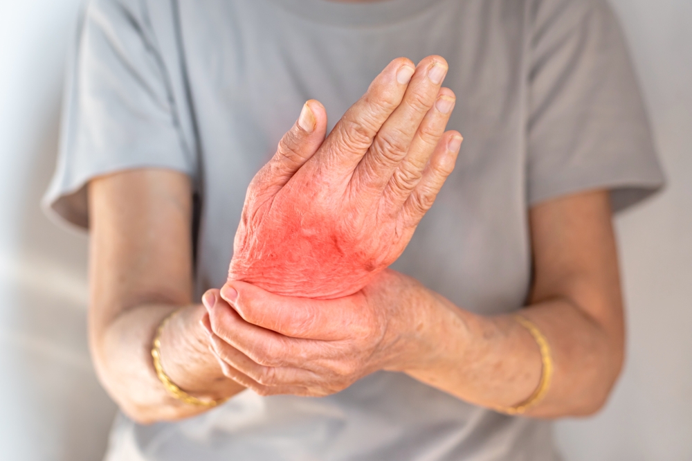 Knee Joint Swelling – Causes, Diagnosis, and Treatment