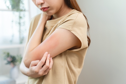 Rash with Burning Sensation, Pain, or Tingling: Causes, Diagnosis & Treatment