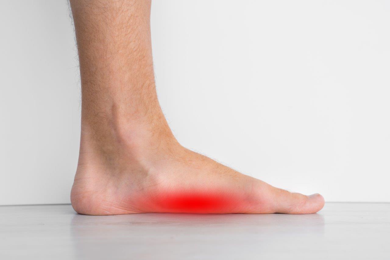Swelling and Stiffness in the Arch of the Foot – Causes, Diagnosis and Treatment