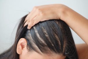Hair and Scalp Treatments in business bay