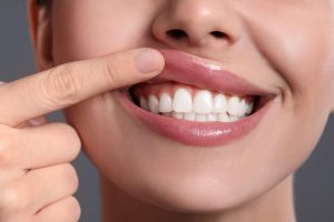 Dental treatment in dubai