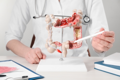 Lynch Syndrome Management